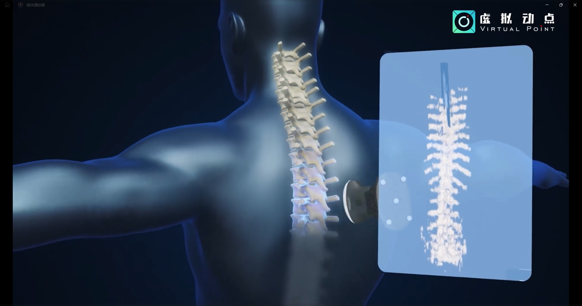 德晋贵宾厅·虚拟动点OptiTrack开创3D超声成像在脊柱诊断中的应用